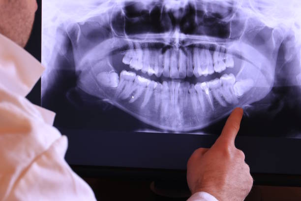 Best Emergency Tooth Extraction in Ashland, KY